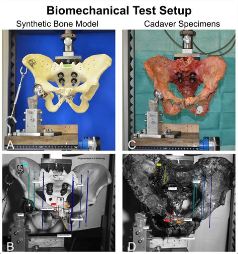 biomechanics bending testing machine|mechanical testing of bones.